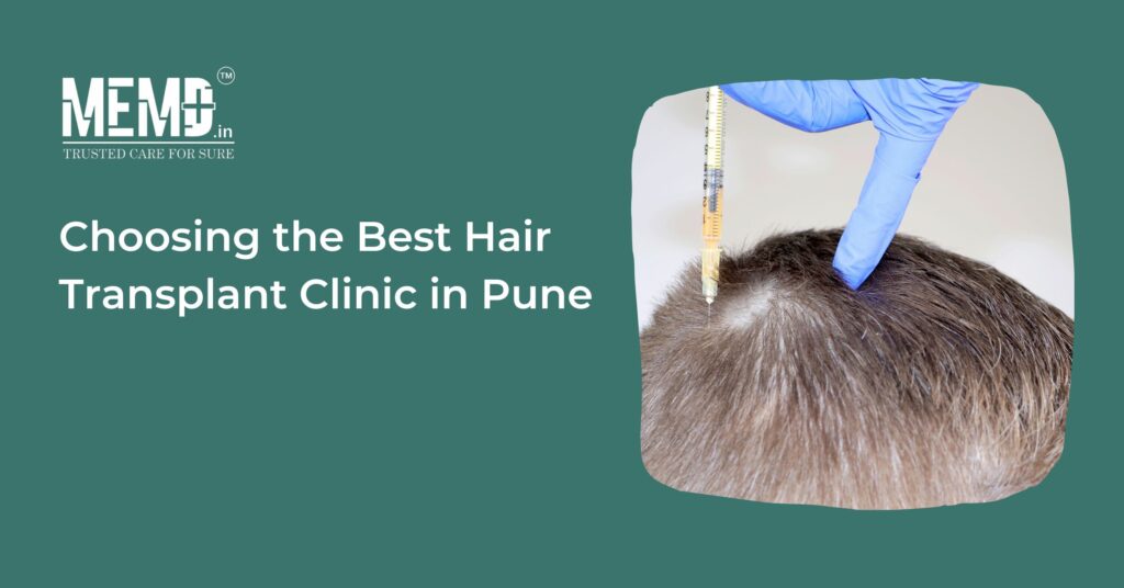 Choosing The Best Hair Transplant Clinic In Pune - CharakAshtanga Ayurved