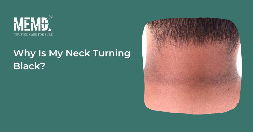 Why Is My Neck Turning Black?